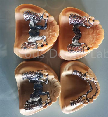 دندان مصنوعی انعطاف پذیر قابل برداشتن با ثبات طولانی مدت و راحتی تنظیم پذیر