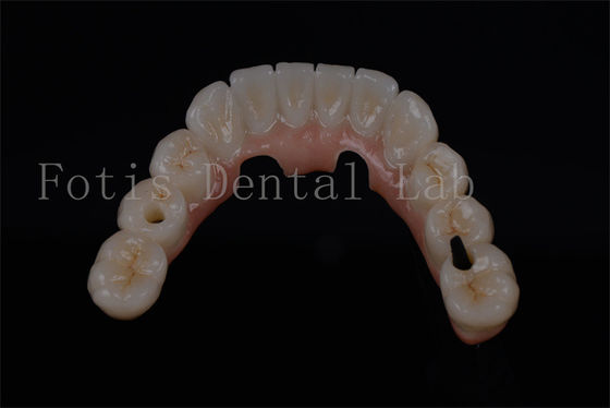 خرید طبیعی به نظر می رسد همه در چهار دندان در یک روز برای هر سن در دسترس online manufacture