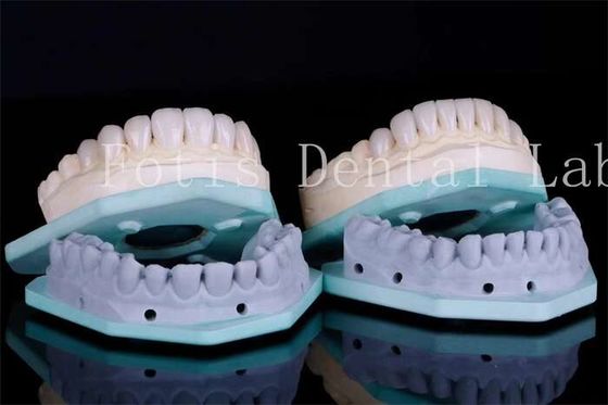 فنیرهای دندان مقاوم به لکه فنیرهای کلینیک دندان ضخامت 0.3mm-0.5mm