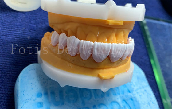 تاج دندان دیجیتال پیشرفته ایمپلنت تاج دندان FDA / ISO / CE گواهینامه
