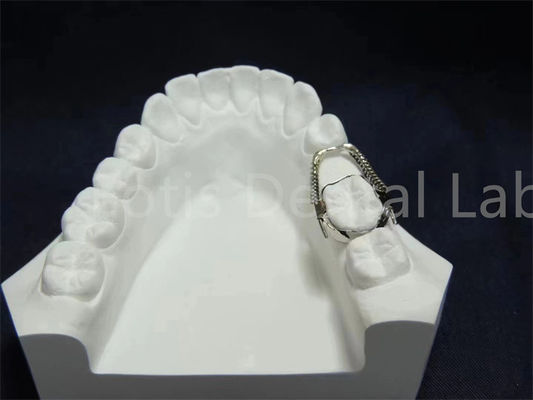نگهدارنده قابل تنظیم گسترش دهنده راه حل ارتودنسی راحت نگهداری آسان