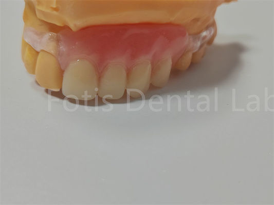 گواهینامه FDA / ISO TCS Valplast دندان های مصنوعی انعطاف پذیر آسان برای تمیز کردن تنظیم
