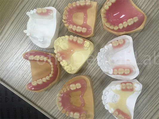 دندانهای انعطاف پذیر TCS Valplast قابل برداشت و قابل تنظیم