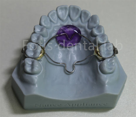 لابراتوار دندانپزشکی مقرون به صرفه ارتودنسی توسع کننده نگهدارنده موثر در حفظ و گسترش دندان