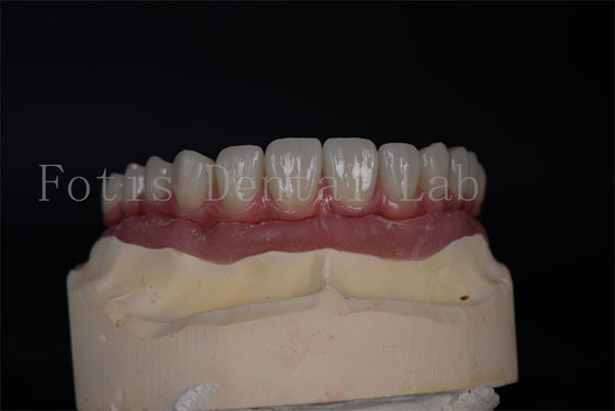 قیمت خوب زیبایی طبیعی با قیمت مناسب همه در 4 همه در 6 ایمپلنت آنلاین
