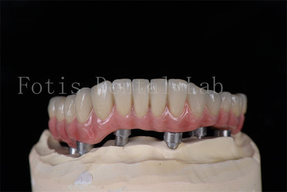 قیمت خوب حداقل تهاجمی در همان روز همه روی 4 همه روی 6 ایمپلنت طبیعی به نظر می رسد آسان برای تمیز کردن آنلاین