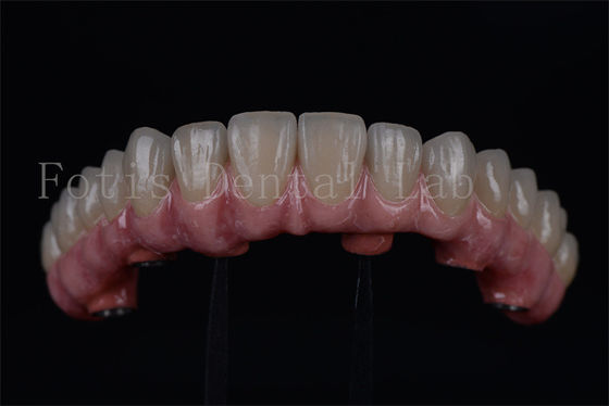 قیمت خوب تيتانيوم / زيركونيا طولاني مدت تمام در 4 تمام در 6 بهبود سريع 1-2 هفته آنلاین