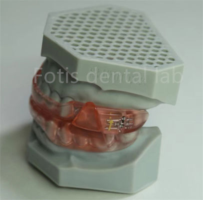لابراتوار دندانپزشکی ارزان قیمت Hyrax Expander ارتودنسی نگهدارنده آسان برای تمیز کردن و نگهداری